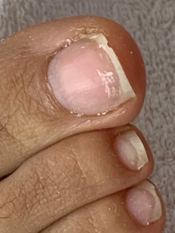 Pedicura rusa: antes